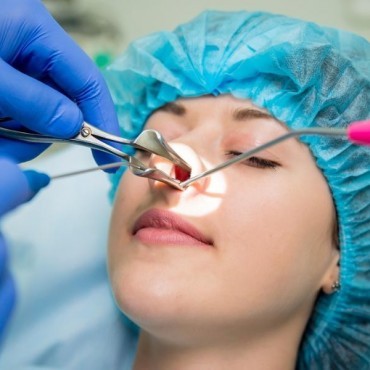 Cirurgia Endoscópica Nasal em Ipameri
