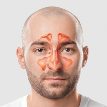 Sinusectomia em Ipameri