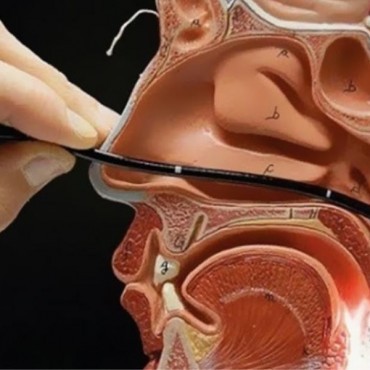 Nasofibrolaringoscopia flexível em Ipameri