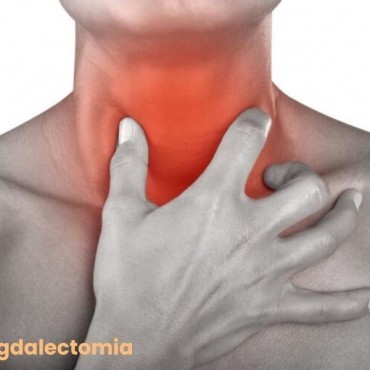 Amigdalectomia em Anápolis